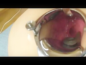 Live eel anal insertion with speculum 2